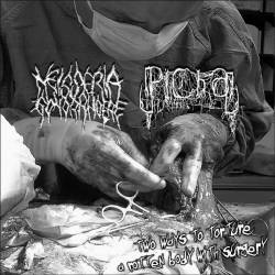 Picha : Two Ways to Torture a Rotten Body with Surgery